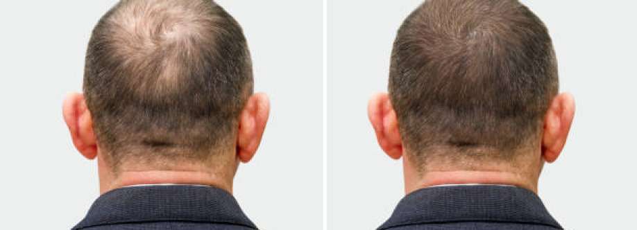 Zubair saudi Cover Image